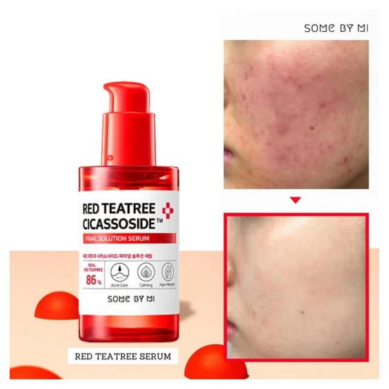 Some by Mi Red Tea Tree Cicassoside Derma Solution Serum 50ml