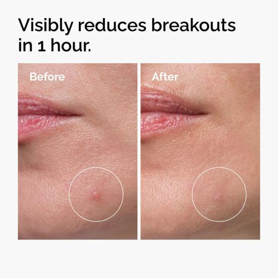 The Ordinary Sulphur 10% Powder-to-Cream Concentrate 5g