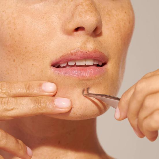 Tweezerman Blackhead Extractor