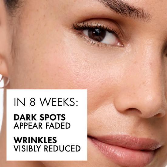 Vichy Specialist B3 5% Niacinamide & AHA Complex Dark Spots & Pigmentation Serum 30ml