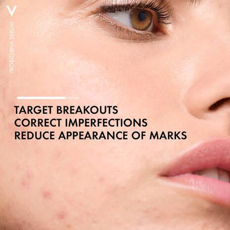 Vichy Normaderm BHA + Probiotic Fractions Anti-Imperfections Serum For Blemish-Prone Skin 30ml