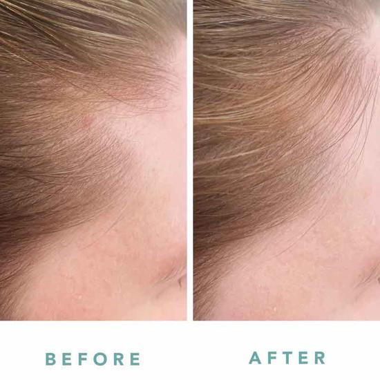WE ARE PARADOXX Growth Accelerate Advanced Scalp Serum 50ml