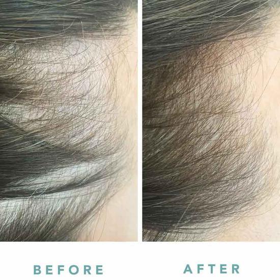 WE ARE PARADOXX Growth Accelerate Advanced Scalp Serum 50ml
