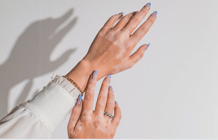 easy nail art ideas