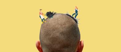 Buzzcut Hair Growth