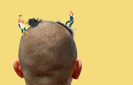 Buzzcut Hair Growth