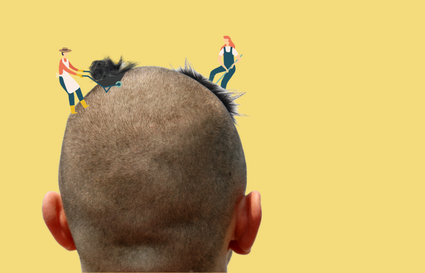 Buzzcut Hair Growth