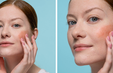 The Best Cream Blushers for a Healthy Glow