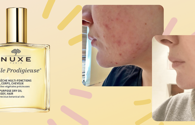 REVIEW: The NUXE Dry Oil That Saved My Skin
