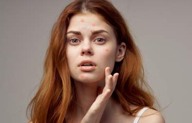 The 20 Best Moisturisers for Acne