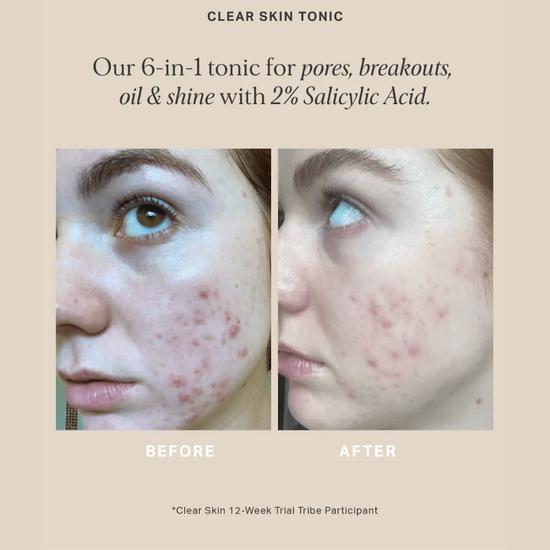 Alpha-H Clear Skin Tonic With 2% BHA Salicylic Acid 3 oz