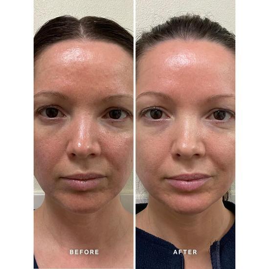 Alpha-H Vitamin B Serum With 5% Niacinamide 0.8 oz