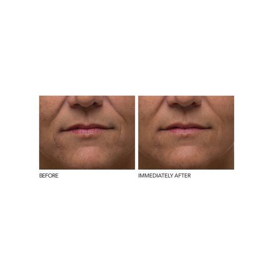 Dr Dennis Gross Skincare Alpha Beta Extra Strength Daily Peel Pack of 5