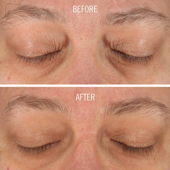 First Aid Beauty Skin Lab Retinol Eye Cream With Triple Hyaluronic Acid