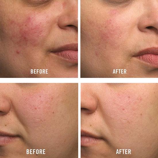 First Aid Beauty Ultra Repair Cream 6 oz