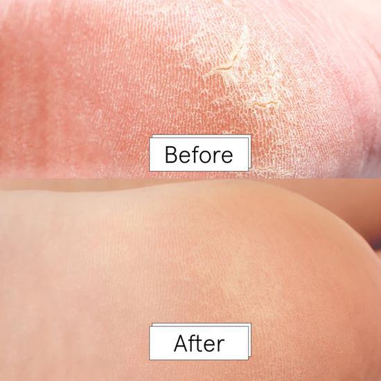 Grace & Stella Dr. Pedicure Foot Peeling Mask Coconut