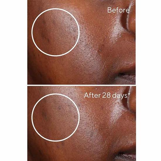 Murad Environmental Shield Rapid Dark Spot Correcting Serum 1 oz