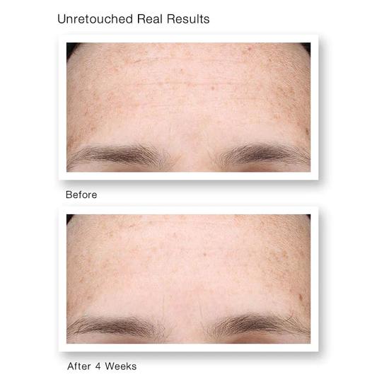 Murad Multi Vitamin Infusion Oil