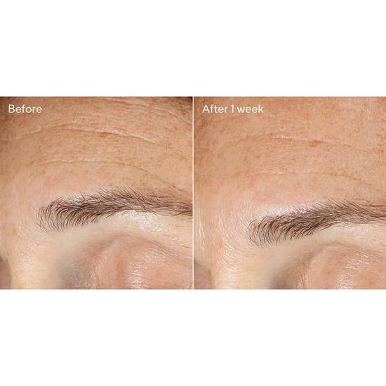 Murad Replenishing Multi Acid Peel