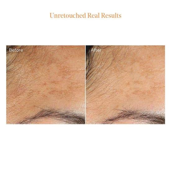 Murad Vita-C Glycolic Brightening Serum 1 oz